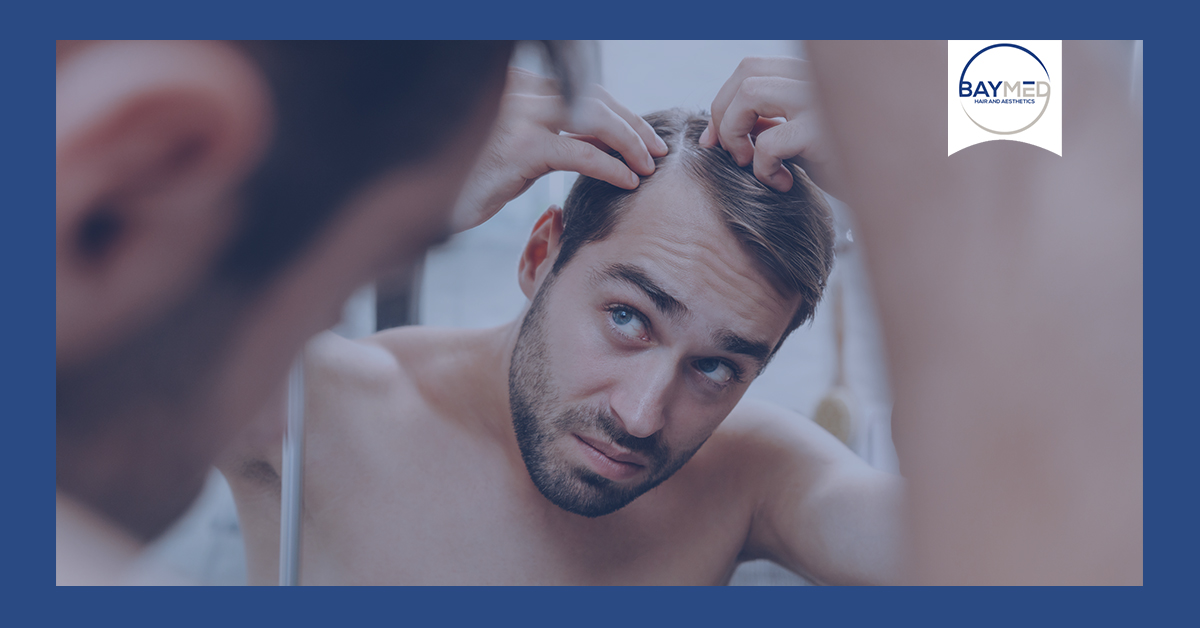 testosterone and hair loss