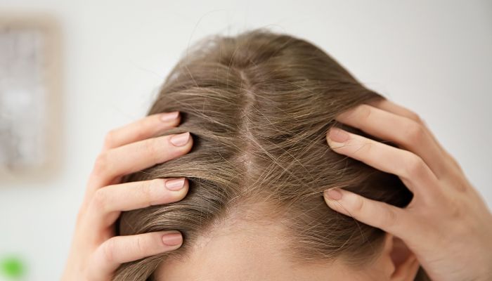 Early Signs of Hair Loss You Shouldn’t Ignore