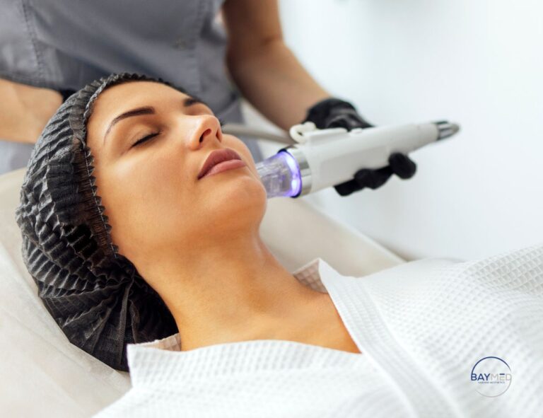 Virtue RF Microneedling