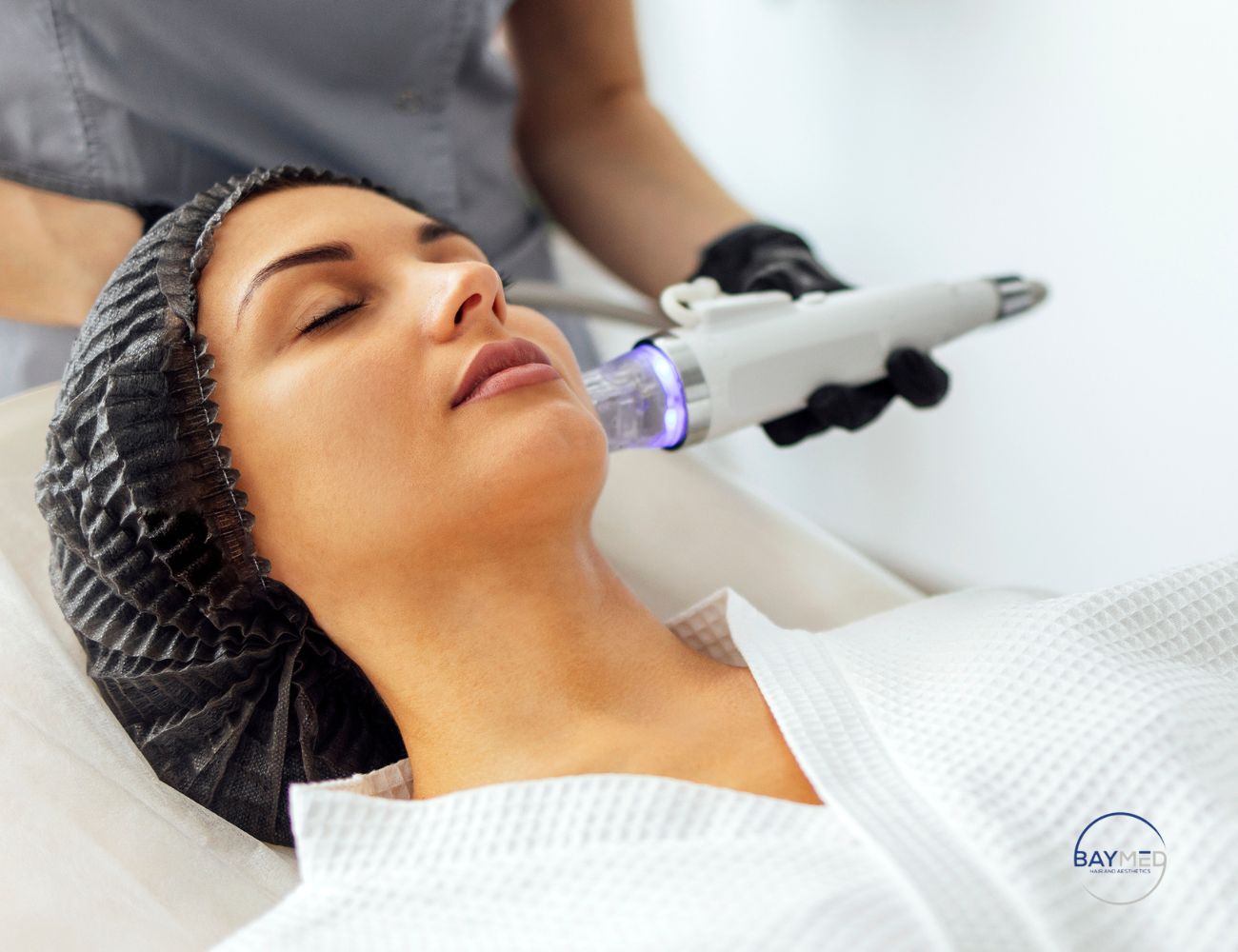 Virtue RF Microneedling