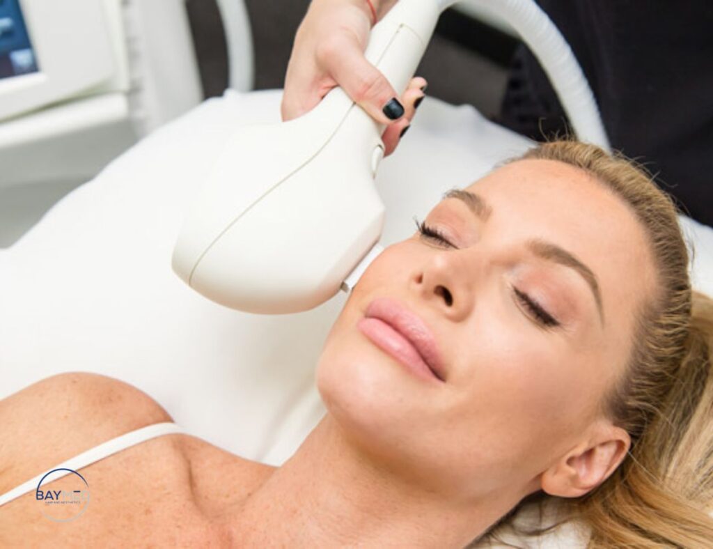 venus versa laser hair removal in Florida