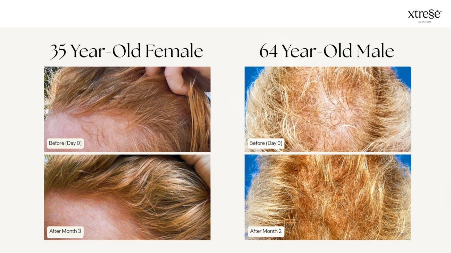 Xtressé Hair Therapy - before and after4
