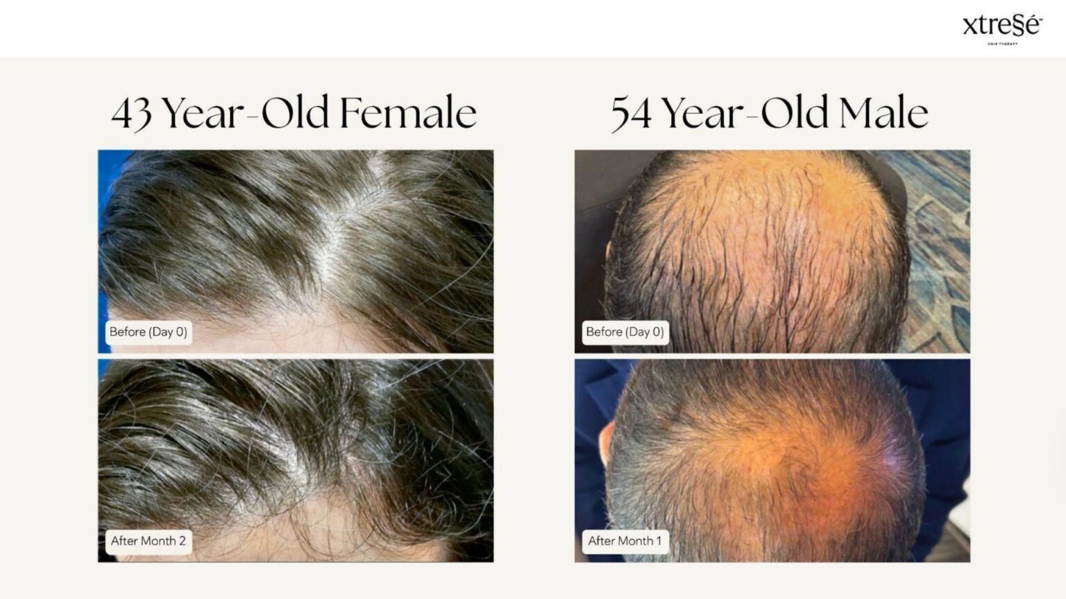 Xtressé Hair Therapy - before and after7