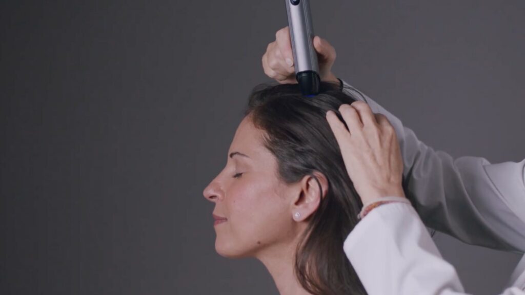 hair loss treatment for women st petersburg1